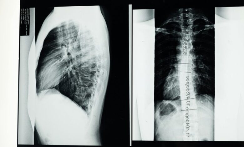 diagnosing pavatalgia disease guide